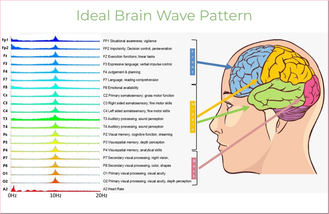 EEG Brain Mapping